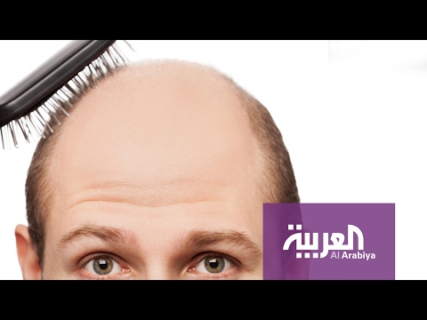 شاهد الخلايا الجذعية علاج لتساقط الشعر والصلع